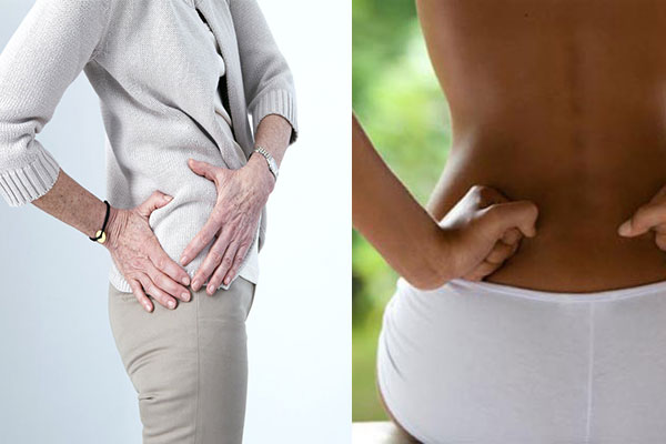 Đau hông - Hình ảnh minh họa